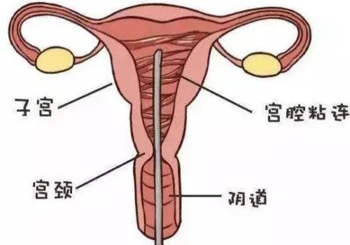 这四种情况容易导致胎儿畸形，大排畸检查通过后也可能出现异常_1